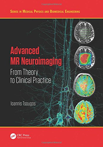 Advanced MR Neuroimaging: From Theory to Clinical Practice – Ioannis Tsougos – eBook