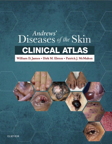 Andrews’ Diseases of the Skin Clinical Atlas - eBook