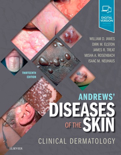 Andrews’ Diseases of the Skin: Clinical Dermatology (13th Edition) – eBook