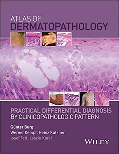 Atlas of Dermatopathology: Practical Differential Diagnosis by Clinicopathologic Pattern – eBook PDF