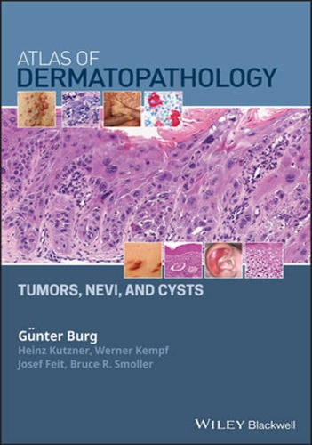 Atlas of Dermatopathology: Tumors, Nevi, and Cysts – eBook