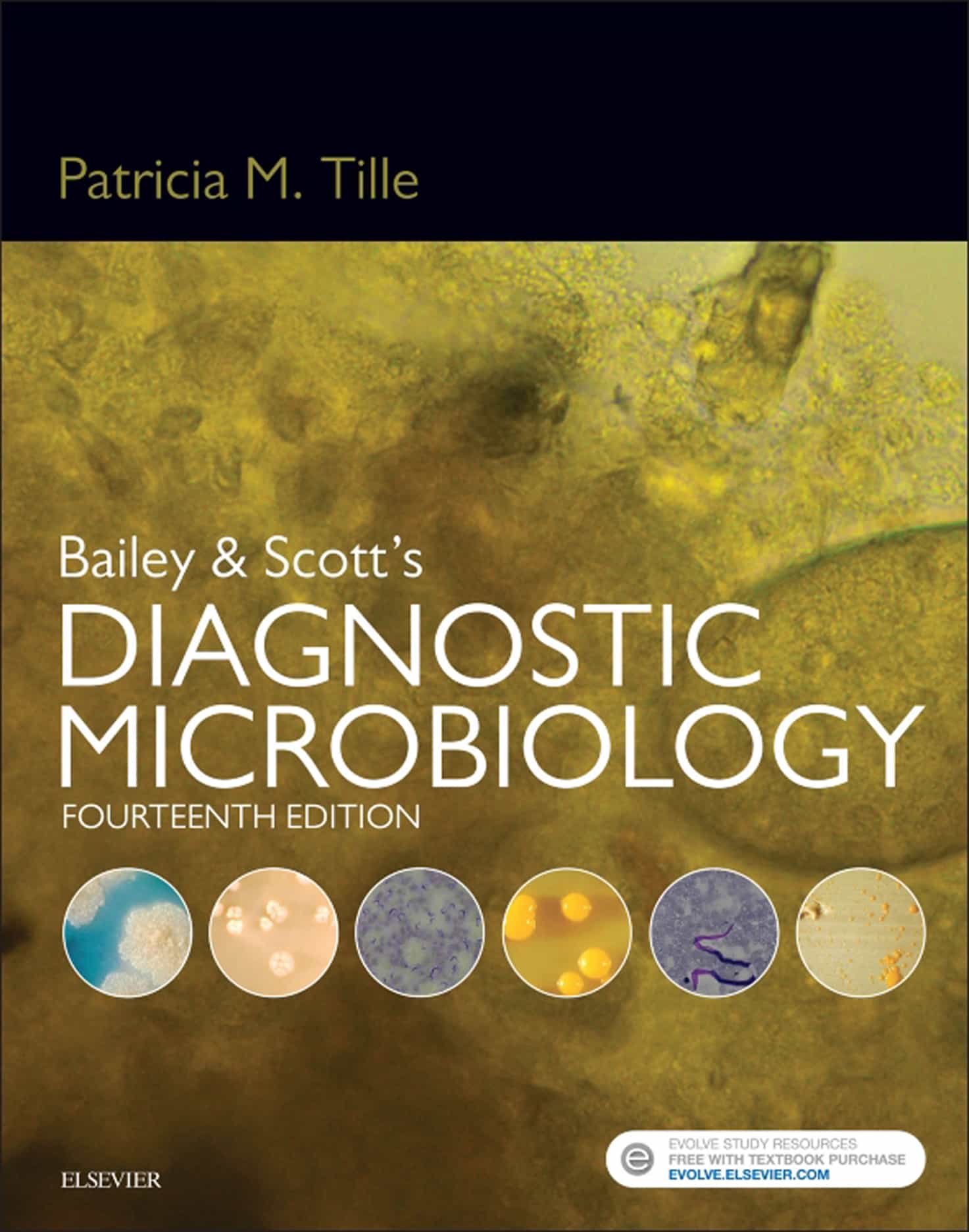 Bailey and Scott’s Diagnostic Microbiology (14th Edition) – eBook PDF