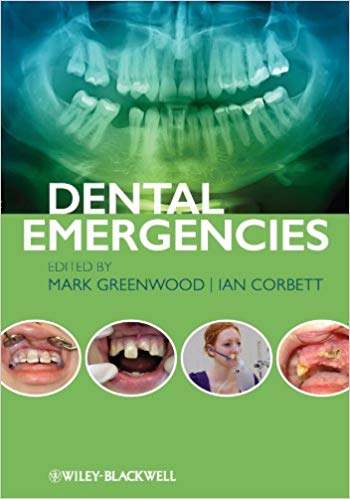 Dental Emergencies – eBook PDF