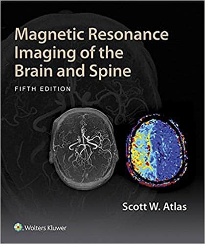 Magnetic Resonance Imaging of the Brain and Spine (5th Edition) – eBook PDF