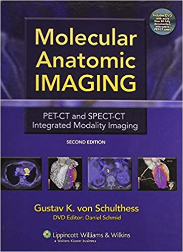 Molecular Anatomic Imaging: PET-CT and SPECT-CT Integrated Modality Imaging (2nd Edition) – eBook PDF