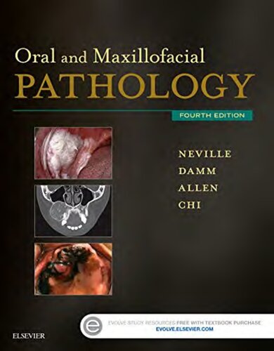 Oral and Maxillofacial Pathology (4th edition) – eBook PDF