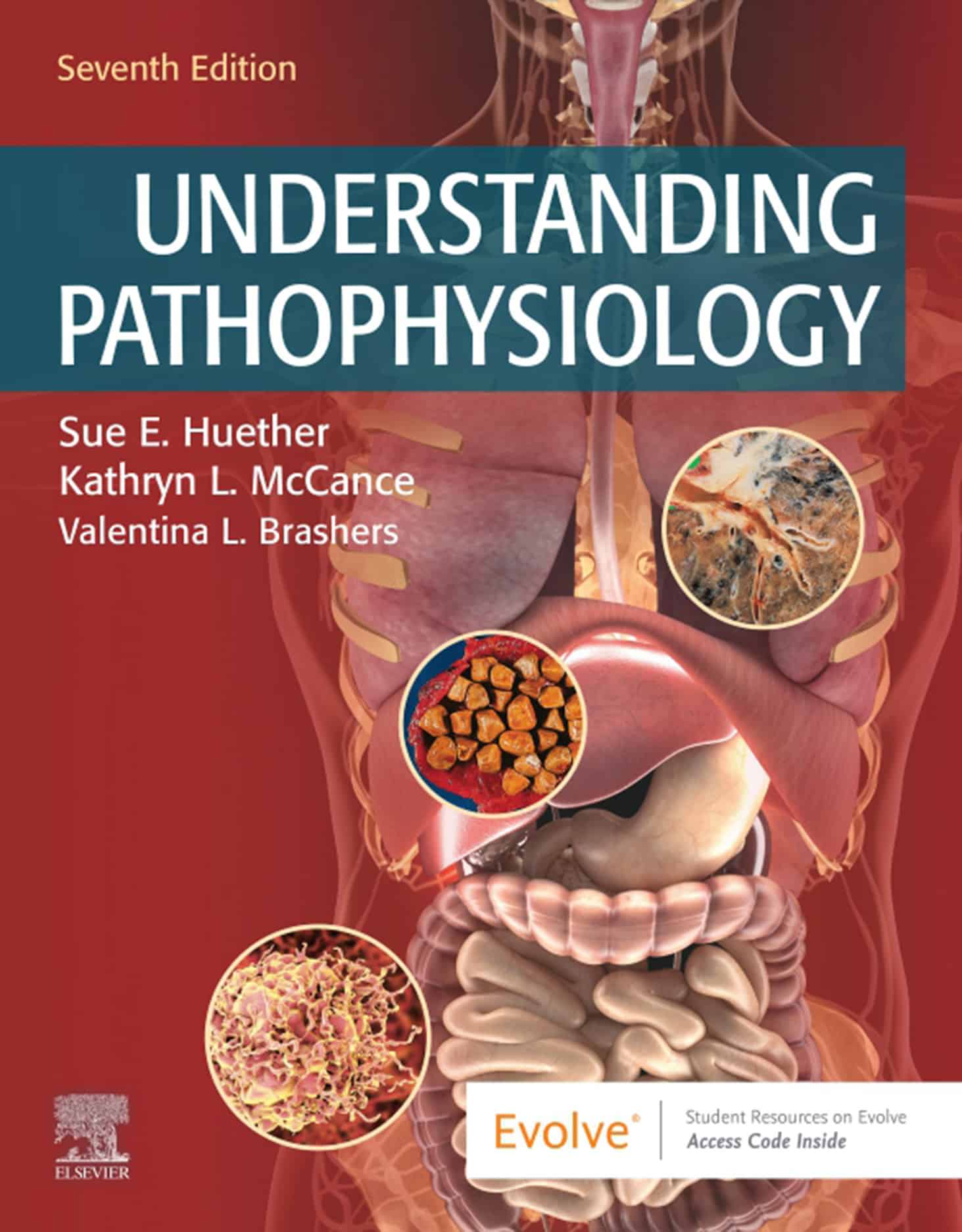 Understanding Pathophysiology (7th Edition) – eBook PDF